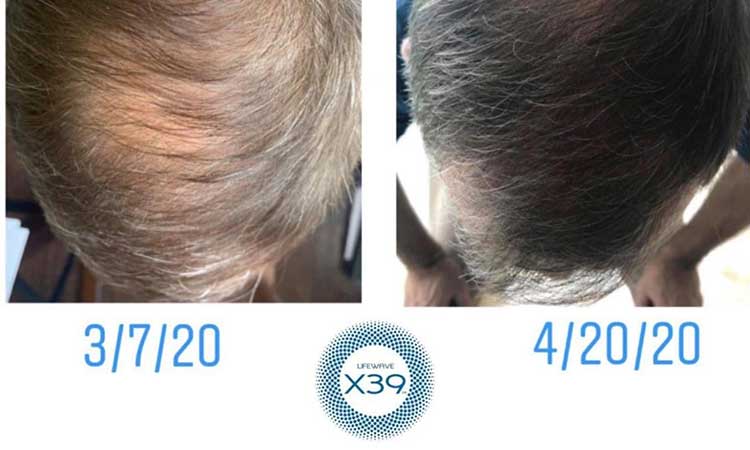 LifeWave LifeWave Therapy LifeWave LifeWave Therapy